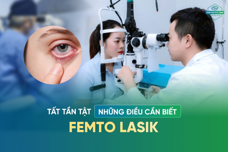 phau thuat khuc xa femto lasik